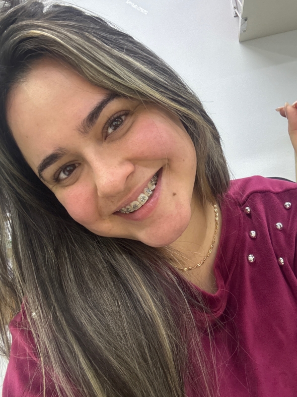 Its a new tap in mi life. I love my perfect smile. 
